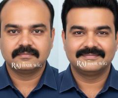 Men’s Hair Wig Shop in Delhi – Raj Hair Wig