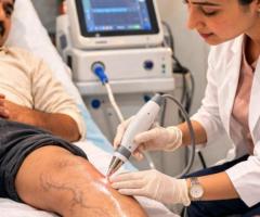 Varicose veins treatment in Balewadi - The Aesthetic Hub