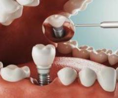 Dentist in Tolichowki Hyderabad