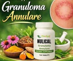 Natural Supplements for Granuloma Annulare Skin Lesions fast