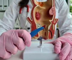 Advanced Care for Fistula and Fissure Problems in Delhi