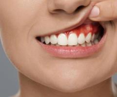 Gentle Dentist in Paddington Brisbane – Emergency & Cosmetic Dental Care