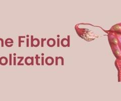 UFE Treatment for Uterine Fibroids | Minimally Invasive Care