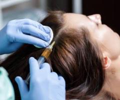 PRP Hair Treatment in Riyadh