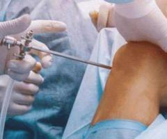 Advanced Joint Replacement & Orthopedic Care Services