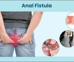 Permanent Relief with Expert Ayurvedic Piles & Fissure Care in Delhi